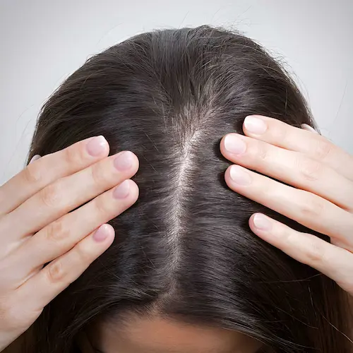 Scalp Care & Anti-Dandruff Shampoos